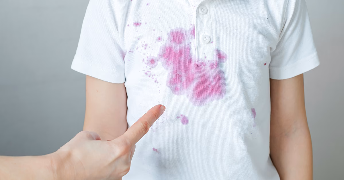 ¿Cómo reducir las manchas de la piel?