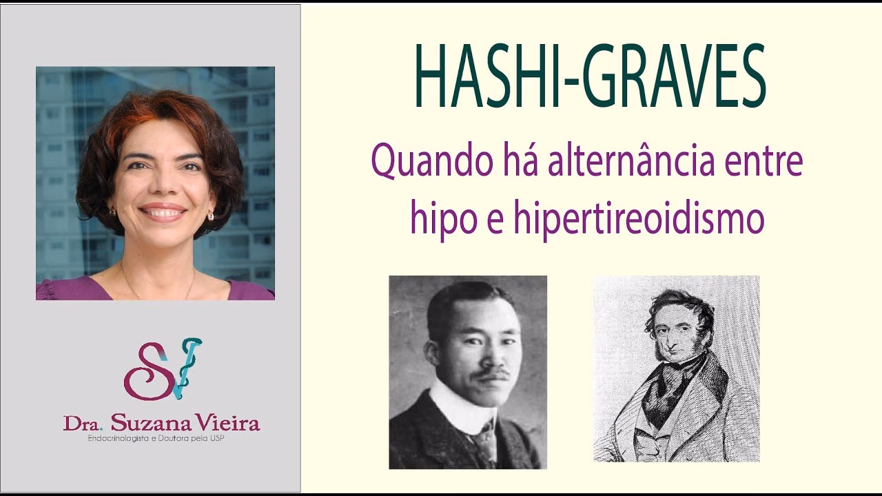 ¿Cuáles son los síntomas de la enfermedad de Hashimoto?