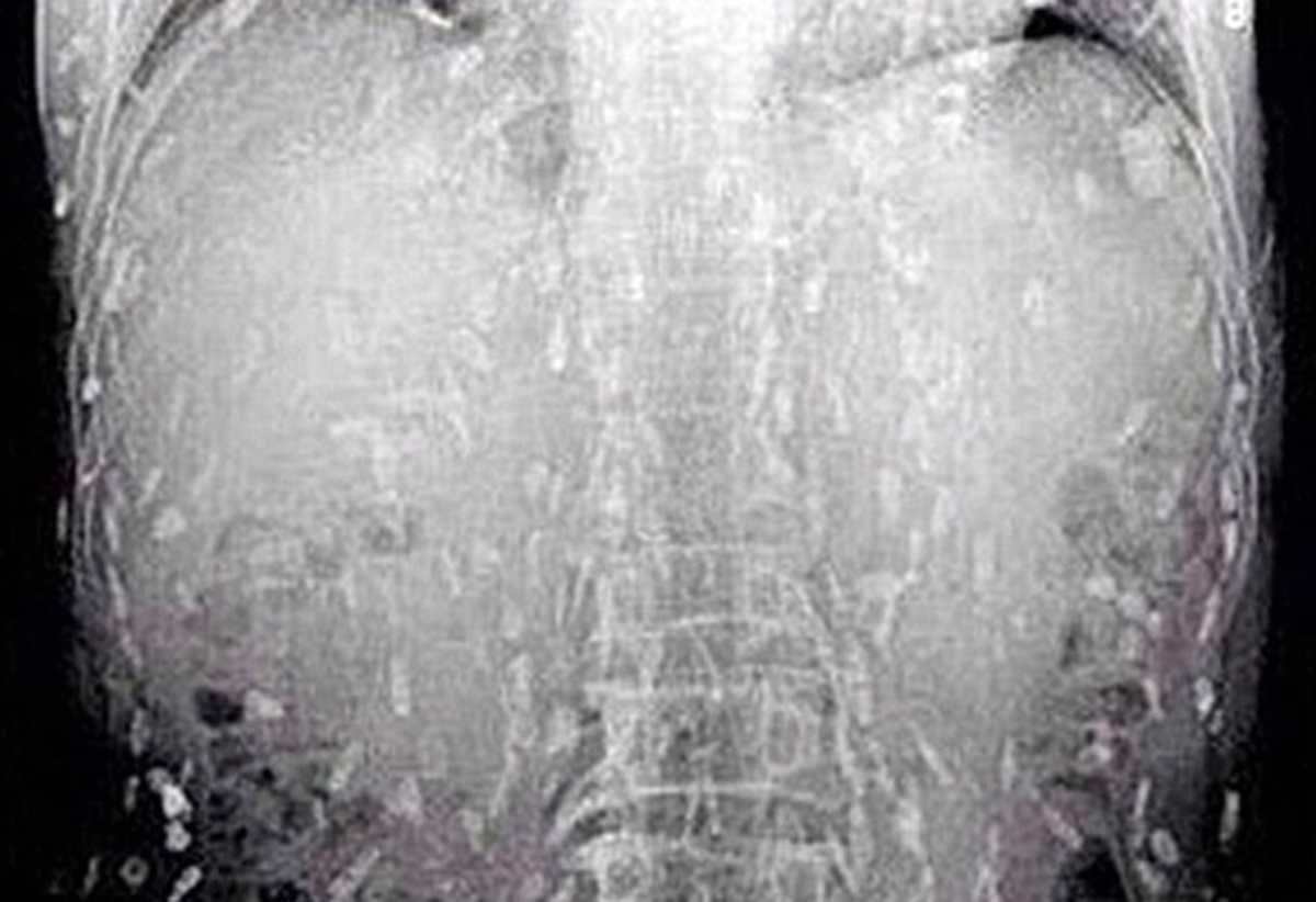 ¿Cuáles son los peligros del sushi y el sashimi?